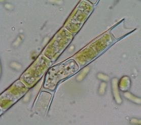 Tribonema vulgare (příprava preparátu z kultury) Trichální řasa, buněčná stěna je dvoudílná,