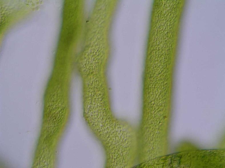 oogonium sifonální vlákna s drobnými chloroplasty Výskyt: stojaté