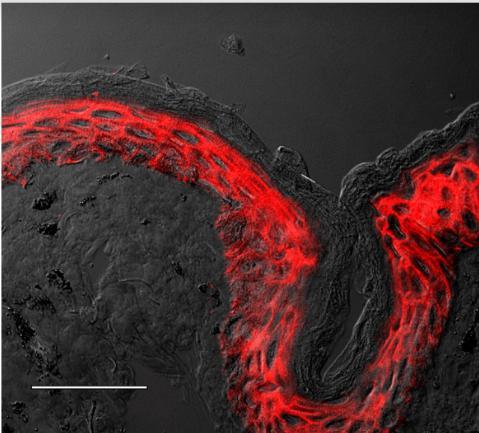 Další z technik, jejichž užívání je rozšířené je imunohistochemie (IHC) jedná se o techniku, která je kombinací imunologických a chemických reakcí vizualizovaných pomocí fotonického mikroskopu.