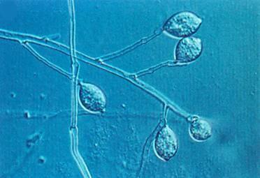 Fungi v užší slova smyslu říše Chromista, Protozoa v širším pojetí