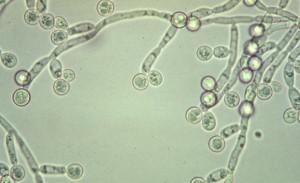 Charakteristika mikroskopických hub Vegetativní stélka: přehrádkované mycelium coenocytické mycelium pseudomycelium pučící elipsoidní buňky jednobuněčná nemyceliální stélka blastokonidie