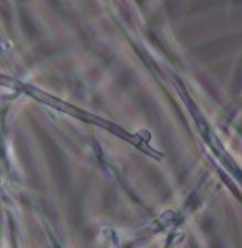 Ascomycota - Basidiomycota CCM F-795