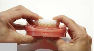 Obrázek 12 Pozičnípomůcka umožňuje snadné umístění umělých zubů do otvorů vyfrézovaných pro fyzické zuby.