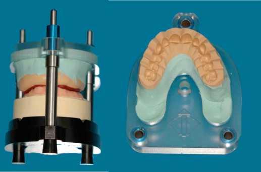 Obrázek 24 - zajištění přesné polohy zubů ve vertikulátoru (10) 16. Odstranění gingivální části ze silikonového klíče 17. Zdokonalení báze pomocí silikonu a.