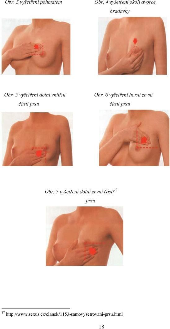 Obrázek 4 Souhrnný obrázek samovyšetření prsu 4) V další fázi