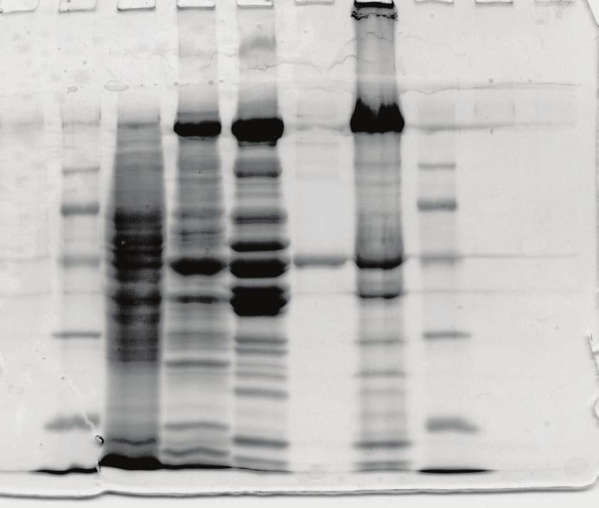 Separace tkáňových proteinů v PAAG 1 2 3 4 5 6 7 Myosin (těžký řetězec) Aktin Tropomyosin Myosin (lehký řetězec)