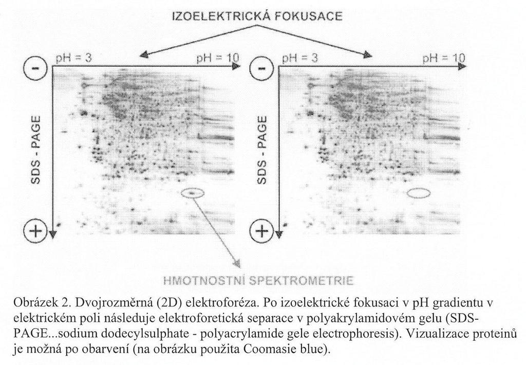 Výsledné mapy proteinů se porovnávají s kontrolními vzorky (pacienti s konkrétním onemocněním a