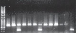 (barvení ethidium bromidem, UV transiluminátor) po PCR může následovat štěpení restrikční