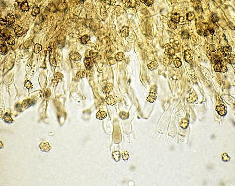 velikost spor přezky lit.: Maas Geesteranus R. A. (1975): Die terrestrische Stachelpilze Europas. - 127 p.