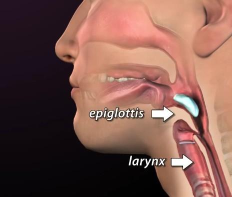 Epiglotitis versus Laryngitis (subglotická laryngitis, laryngotracheitis) Epiglotitis Krup, (pseudokrup) H.