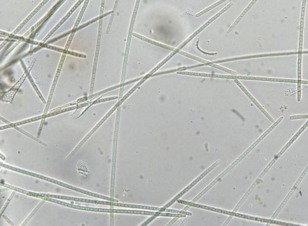 V červenci jsme naměřili vůbec nejvyšší koncentraci chlorofylu a v povodí Moravy. Dominantami byly sinice Anabaena flos aquae a Microcystis aeruginosa.