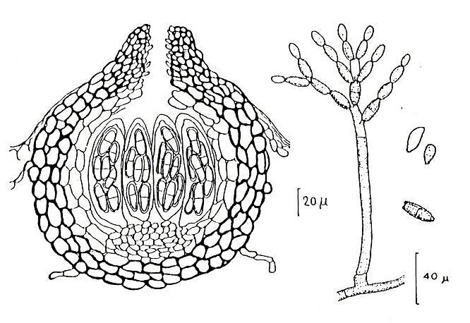 Mycosphaerella