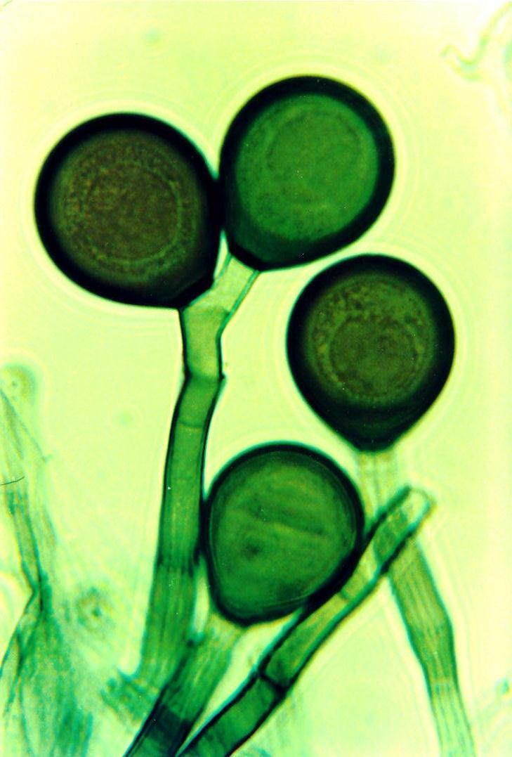Ascomycetes (Pezizomycotina) bitunikátní řády skupina Deuteromycetes základy