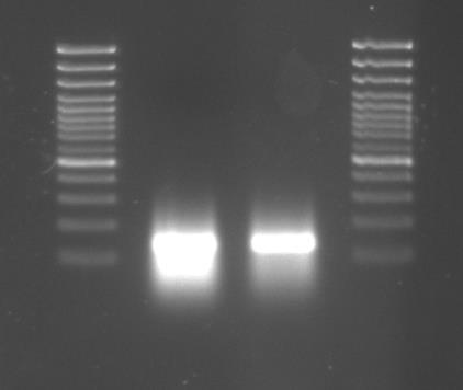 Extrakce celkové RNA proběhla za pomoci kitu RNeasy Mini Plant (Qiagen, USA) s modifikacemi podle Mekuria et al. (2003). Vzorky byly podrobeny ošetření DNázou I (DNAfree, Ambion).