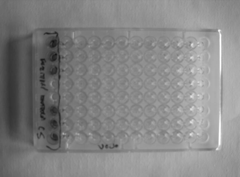 Obr. 11. Detekce markerového genu gus v embryích semen švestky pomocí biochemického barvení, mikrotitrační deska.