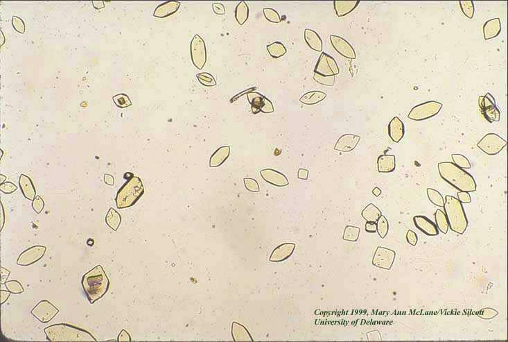 lipidové - krystalové - bakteriální voskový