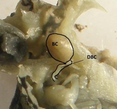 Obr. 4. 15: Dorzální pohled na uloţení kopulační burzy R. peregra při pitvě (autor:leontovyč,nepublikováno) Obr. 4.16: Kopulační burza a její duktus R.