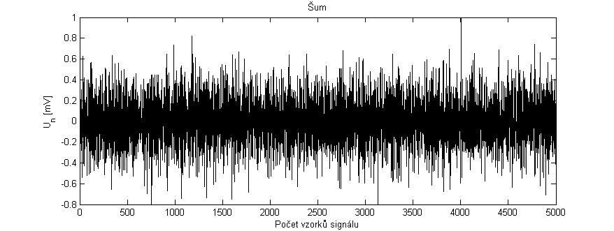 5.2 Zarušení signálu Pro zarušení čistého signálu EKG byl použit přídavný šum. Šum by měl co nejvíce odpovídat reálnému myopotenciálovému rušení, tzn.