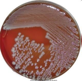 E.coli na agaru EMB (Eosin