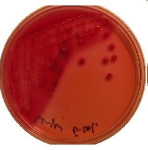Bakteriální kolonie na II.