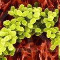 palisády: Corynebacterium tetrády koků: Micrococcus balíčky = sarciny
