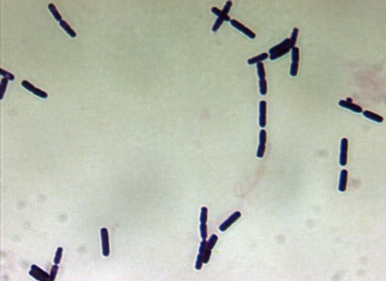 Bacillus cereus CCM 2010