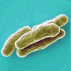 tuberculosis Pleomorfní buňky rodu Corynebacterium
