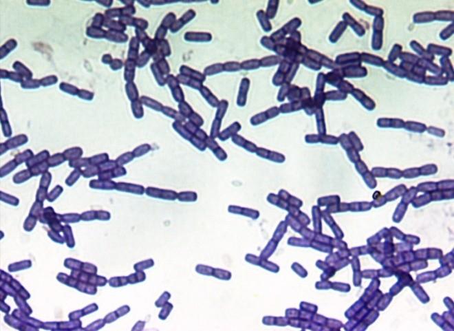 Escherichia coli ( G-