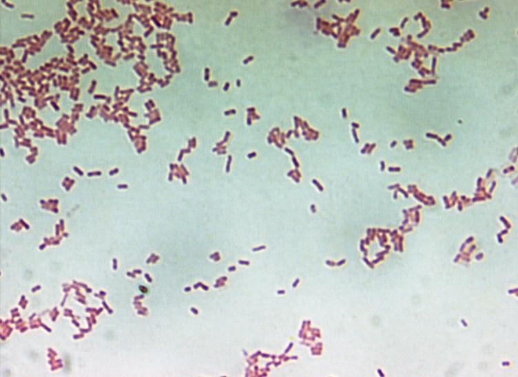 0,4-0,6 um Bacillus