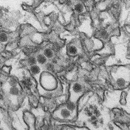 Zika virus Patří do rodu Flavivirus, čeleď Flaviviridae Obalený ikosahedrální