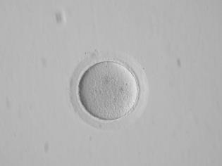 Obr. 5: Oocyt ve fázi MI (E. Blahová, ReproGenesis, 2012) PB (Polar Body) - plně zralé vajíčko s extrudovaným pólovým tělískem s chromosomy ve stadiu metafáze II (MII).