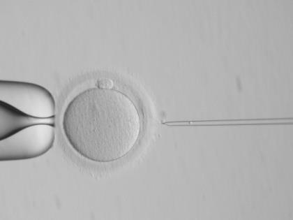 od čtyřbuněčného stádia (Braude et al., 1988). Kvalita DNA u spermií je hodnocena jako absence či výskyt fragmentací v pozdním embryonálním vývoji late paternal effect (Tesarik et al.