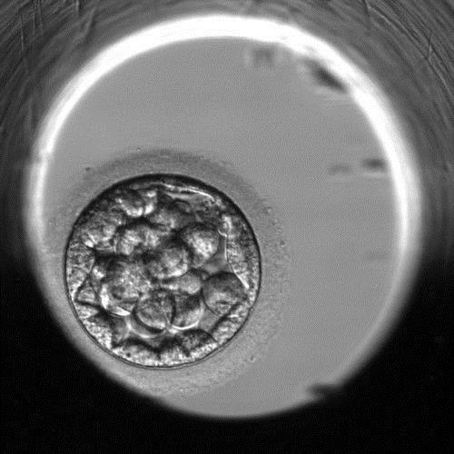 Den 5 - Časná blastocysta Den 5 - Blastocysta Den 5 Expandovaná blastocysta Den 5 Hatchující