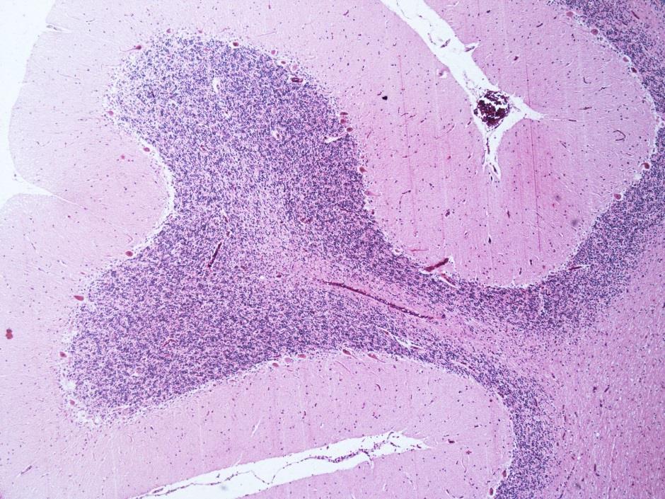 Cerebellum Kůra mozečku (cortex cerebelli) Stratum moleculare - košíčkové a