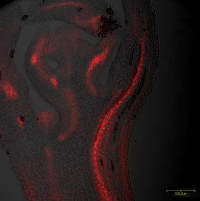 Obr. 15: Imunohistochemická lokalizace PIN1 proteinu v 2.