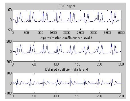 Obr. 10: EKG signál po vlnkové transformaci typu Haar úrovně 4 [2].