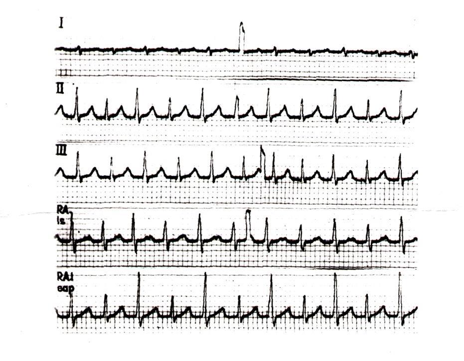 NÁLEŽITOSTI EKG VYŠETŘENÍ data pacienta datum