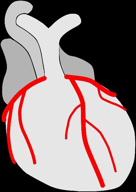Lokalizace ischemického ložiska avr I avl ACD 5 ACS 2 1 6 RIA 3 RC 4 RD RM ACD arteria coronaria dextra ACS arteria coronaria sinistra RIA