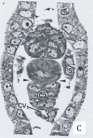 tabulek vývoje (Piavis, 1961; Tahara, 1988; Meeuwig et al., 2006).