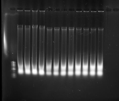 Separace izolované DNA horizontální elektroforézou v agarovém gelu Černobílá fotografie pomocí