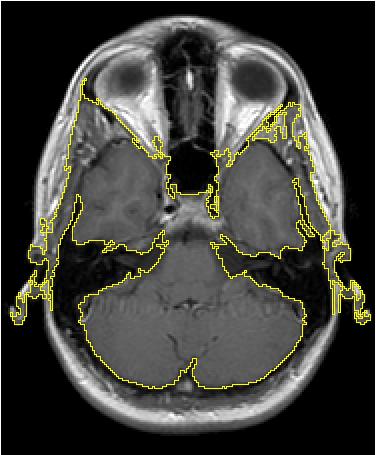 postmortem techniky in vivo