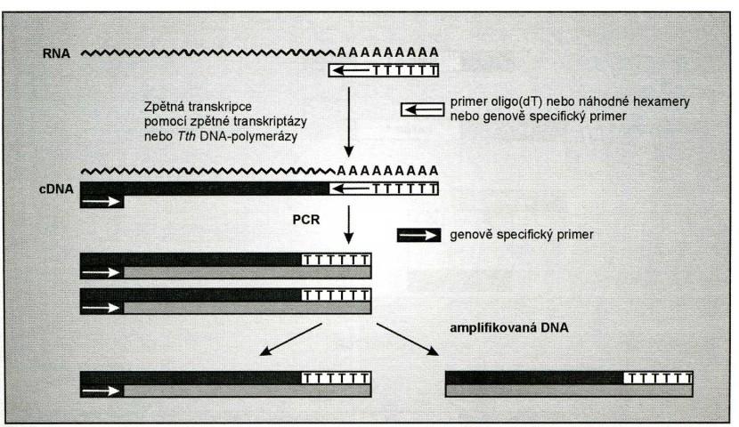 Zpětná (reverzní) transkriptáza (retroviry) Patří do skupiny RNA-dependentních DNA-polymeráz. Katalyzuje přepis genetické informace z RNA do DNA.