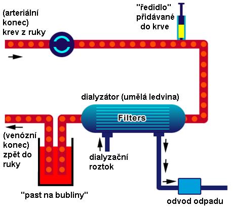 roztoku According to: www.renalpatients.co.uk/ haemodialysis.