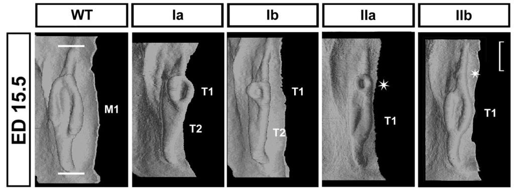 Obrázek 12. 3D rekonstrukce zubního epitelu u WT zárodků a u jednotlivých Tabby morfotypů. Hmotnost embryí 301 350 mg. M1 značí pohárek první stoličky u WT zárodku.
