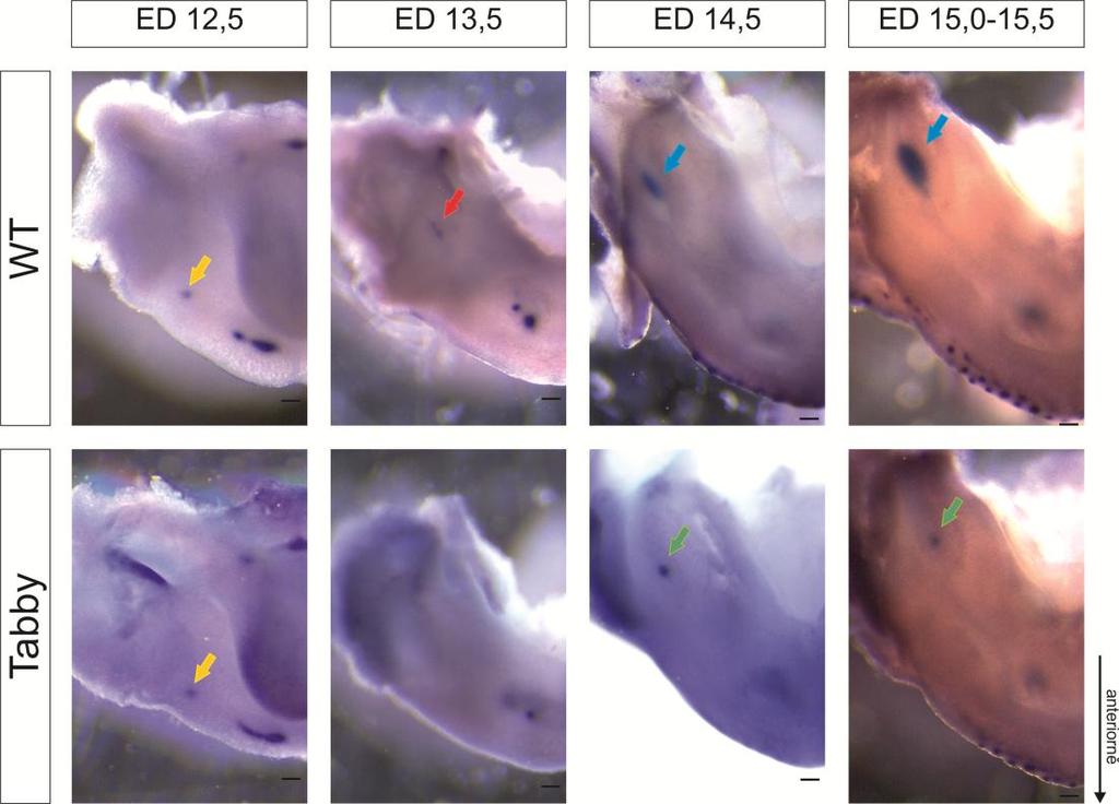 4.2 Tvářová oblast Pro posouzení, jaký má Tabby mutace vliv na průběh vývoje zubů v tvářové oblasti dolní čelisti, jsme vizualizovali Shh expresi pomocí whole mount in situ hybridizace (WISH) od ED
