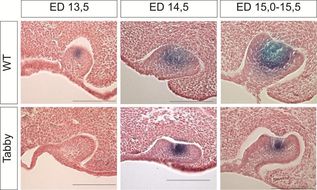 Obrázek 20. Exprese Shh na frontálních řezech dolní čelistí WT a Tabby embryí vizualizovaná pomocí WISH.
