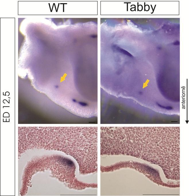 Obrázek 21. Exprese Shh v tvářové oblasti u WT (85 mg) a Tabby (65 mg) zárodků stáří ED 12,5. Žlutá šipka značí bodovou Shh expresní doménu patřící rudimentu MS. Měřítko znázorňuje 100 µm. 4.2.2 ED 13,5 V dolní čelisti o jeden den starších zárodků jsme detekovali Shh expresi pouze u kontrolních (WT) vzorků.