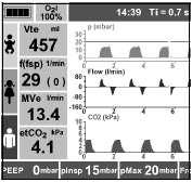 5.9 Monitorování ventilace Všeobecně Během ventilace musíte pacienta neustále monitorovat. Proces ventilace můžete sledovat na displeji, na výběr máte několik formátů zobrazení.