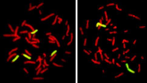 Fluorescenční in situ hybridizace řadíme mezi molekulárně - cytogenetická vyšetření, která umožňují lokalizaci a identifikaci specifické sekvence nukleotidů v DNA, případně RNA.