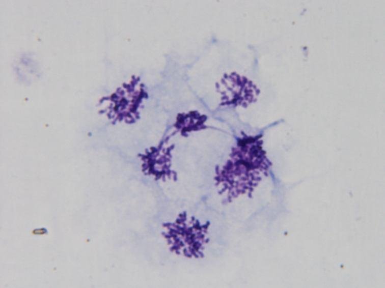 Obr. 19 - Klastry buněk v metafázi mitotického dělení Tyto buňky se nachází v tzv. metafázi mitotického dělení, kdy se v jejím průběhu chromozomy řadí do ekvatoriální roviny dělícího vřeténka.
